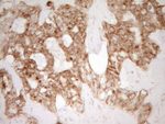 CD40 Antibody in Immunohistochemistry (Paraffin) (IHC (P))