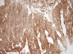 CD40 Antibody in Immunohistochemistry (Paraffin) (IHC (P))