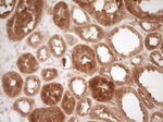 CD40 Antibody in Immunohistochemistry (Paraffin) (IHC (P))