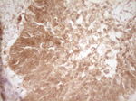 CD40 Antibody in Immunohistochemistry (Paraffin) (IHC (P))