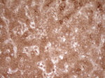 CD40 Antibody in Immunohistochemistry (Paraffin) (IHC (P))