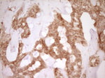 CD40 Antibody in Immunohistochemistry (Paraffin) (IHC (P))