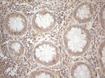 CD40 Antibody in Immunohistochemistry (Paraffin) (IHC (P))