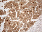 CD40 Antibody in Immunohistochemistry (Paraffin) (IHC (P))