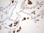 CD40 Antibody in Immunohistochemistry (Paraffin) (IHC (P))