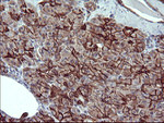 CD44 Antibody in Immunohistochemistry (Paraffin) (IHC (P))