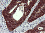 CD44 Antibody in Immunohistochemistry (Paraffin) (IHC (P))