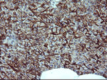 CD44 Antibody in Immunohistochemistry (Paraffin) (IHC (P))