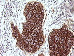 CD44 Antibody in Immunohistochemistry (Paraffin) (IHC (P))