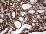 CD44 Antibody in Immunohistochemistry (Paraffin) (IHC (P))
