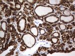 CD44 Antibody in Immunohistochemistry (Paraffin) (IHC (P))