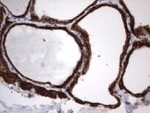 CD44 Antibody in Immunohistochemistry (Paraffin) (IHC (P))