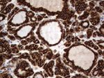 CD44 Antibody in Immunohistochemistry (Paraffin) (IHC (P))