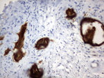 CD44 Antibody in Immunohistochemistry (Paraffin) (IHC (P))