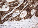 CD44 Antibody in Immunohistochemistry (Paraffin) (IHC (P))