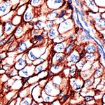 CD44 Antibody in Immunohistochemistry (IHC)