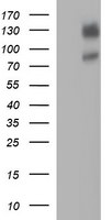 CD44 Antibody in Western Blot (WB)