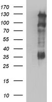 CD44 Antibody in Western Blot (WB)