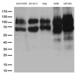 CD44 Antibody in Western Blot (WB)