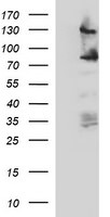 CD44 Antibody in Western Blot (WB)