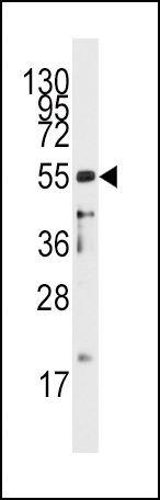 CD4 Antibody in Western Blot (WB)