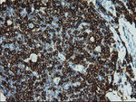 CD5 Antibody in Immunohistochemistry (Paraffin) (IHC (P))