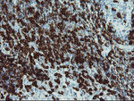 CD5 Antibody in Immunohistochemistry (Paraffin) (IHC (P))