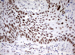 CD5 Antibody in Immunohistochemistry (Paraffin) (IHC (P))