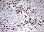 CD5 Antibody in Immunohistochemistry (Paraffin) (IHC (P))