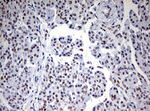 CD5 Antibody in Immunohistochemistry (Paraffin) (IHC (P))