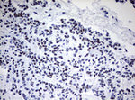 CD5 Antibody in Immunohistochemistry (Paraffin) (IHC (P))