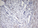 CD5 Antibody in Immunohistochemistry (Paraffin) (IHC (P))