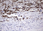 CD5 Antibody in Immunohistochemistry (Paraffin) (IHC (P))