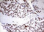 CD5 Antibody in Immunohistochemistry (Paraffin) (IHC (P))