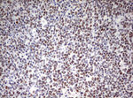 CD5 Antibody in Immunohistochemistry (Paraffin) (IHC (P))