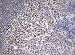 CD5 Antibody in Immunohistochemistry (Paraffin) (IHC (P))