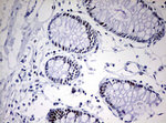 CD5 Antibody in Immunohistochemistry (Paraffin) (IHC (P))