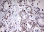 CD5 Antibody in Immunohistochemistry (Paraffin) (IHC (P))