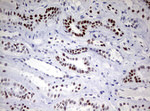 CD5 Antibody in Immunohistochemistry (Paraffin) (IHC (P))