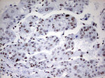 CD5 Antibody in Immunohistochemistry (Paraffin) (IHC (P))