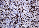 CD5 Antibody in Immunohistochemistry (Paraffin) (IHC (P))