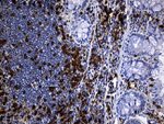 CD5 Antibody in Immunohistochemistry (Paraffin) (IHC (P))