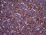CD5 Antibody in Immunohistochemistry (Paraffin) (IHC (P))