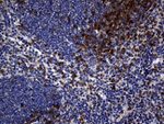 CD5 Antibody in Immunohistochemistry (Paraffin) (IHC (P))