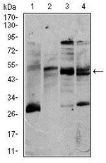 CD5 Antibody in Western Blot (WB)
