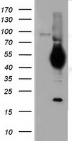 CD5 Antibody in Western Blot (WB)