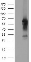 CD5 Antibody in Western Blot (WB)