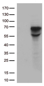 CD5 Antibody in Western Blot (WB)