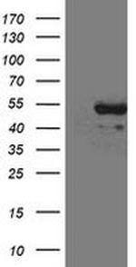 CD5 Antibody in Western Blot (WB)