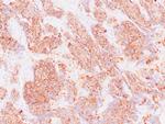 CD56 Antibody in Immunohistochemistry (Paraffin) (IHC (P))